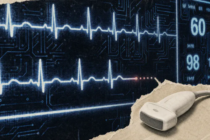 AI ECG Tool Flags Heart Risk in Two Seconds, but Still Needs the Scan That Diagnoses It